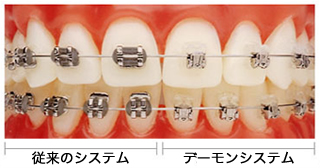 従来のシステムとデイモンシステムの比較