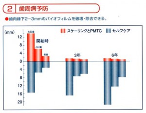 PMTC効果歯周病予防